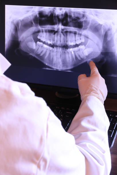 Best Chipped Tooth Repair Near Me  in London, KY