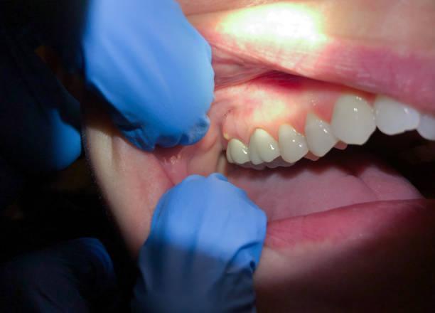 Best Dentist Open Late Near Me  in London, KY