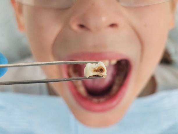 Best Knocked-Out Tooth Emergency  in London, KY